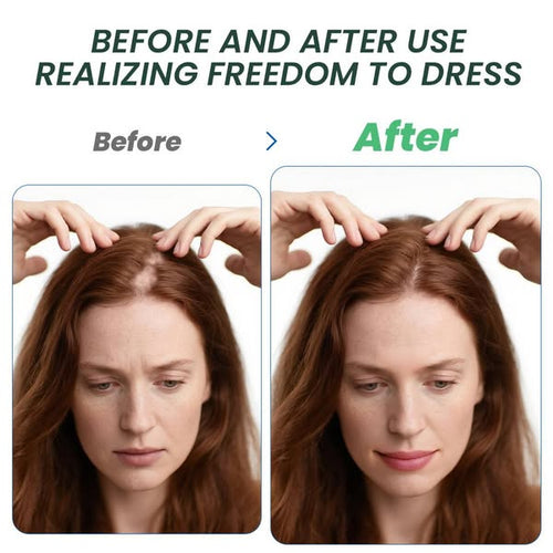Sumifun Alopecia Hair Growth Cream 20g