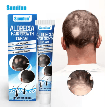 Sumifun Alopecia Hair Growth Cream 20g