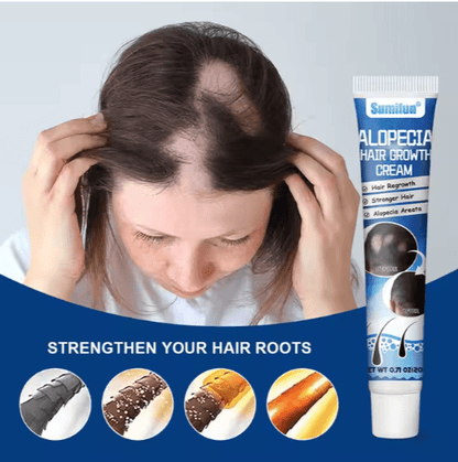 Sumifun Alopecia Hair Growth Cream 20g